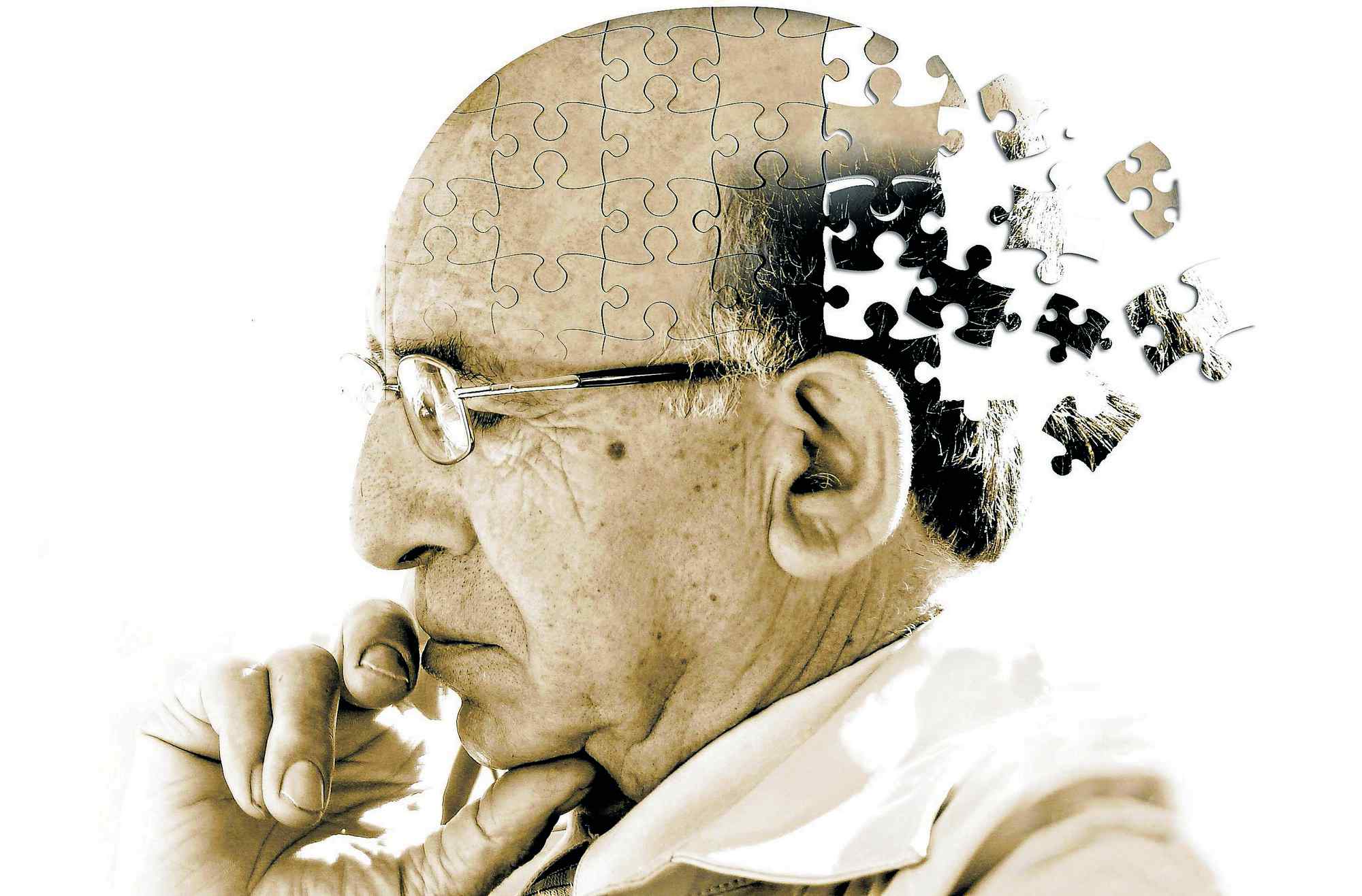 Newly evolved human gene prevents Alzheimer’s